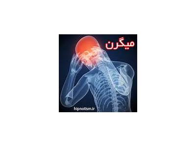 درمان میگرن،بی خوابی واضطراب با هیپنوتراپی در زنجان